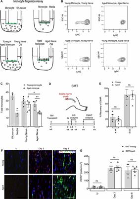 Macrophages and Associated Ligands in the Aged Injured Nerve: A Defective Dynamic That Contributes to Reduced Axonal Regrowth